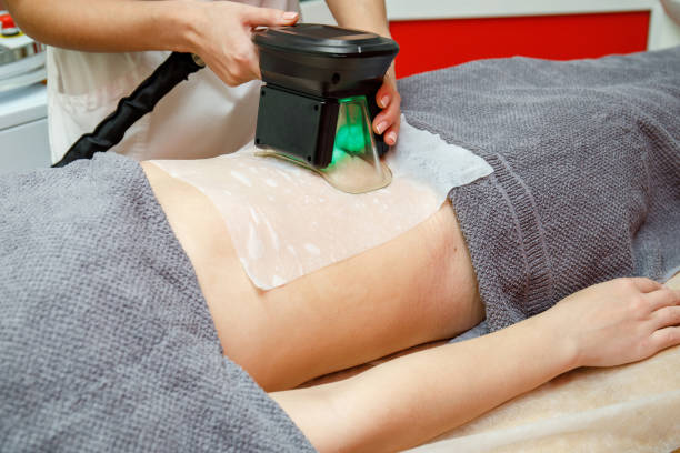 Non-Surgical Fat Reduction