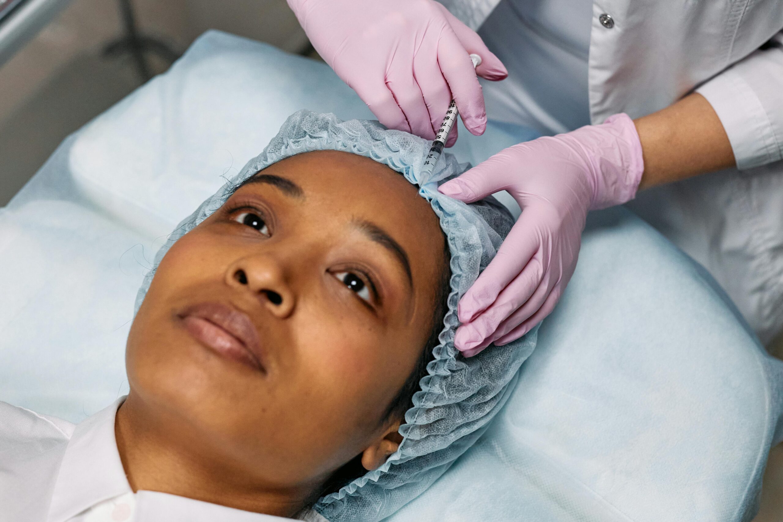 PRP for Hair Loss