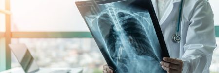 Best X-ray Services in Islamabad